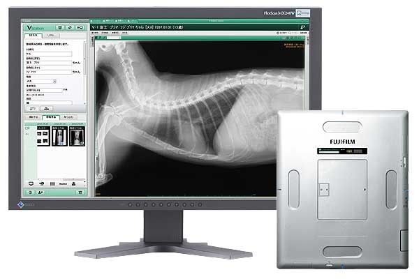 レントゲンDRシステム　（FUJIFILM DR CALNEO Smart V）